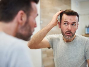 Como evitar la caída de pelo en los hombres